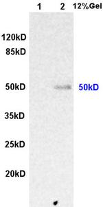 ILK-1 Antibody in Western Blot (WB)