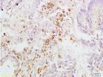 Integrin beta 3 Antibody in Immunohistochemistry (Paraffin) (IHC (P))