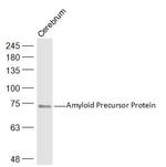 Amyloid Precursor Protein Antibody in Western Blot (WB)