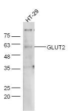 GLUT2 Antibody in Western Blot (WB)