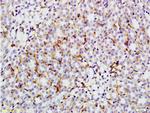 GLUT4 Antibody in Immunohistochemistry (Paraffin) (IHC (P))