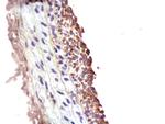 MMP2 Antibody in Immunohistochemistry (Paraffin) (IHC (P))