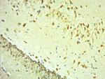 MMP2 Antibody in Immunohistochemistry (Paraffin) (IHC (P))