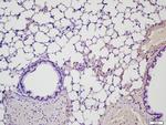 MMP2 Antibody in Immunohistochemistry (Paraffin) (IHC (P))