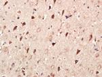 MMP2 Antibody in Immunohistochemistry (Paraffin) (IHC (P))