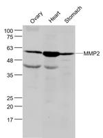 MMP2 Antibody in Western Blot (WB)