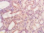 MMP-3 Antibody in Immunohistochemistry (Paraffin) (IHC (P))