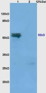 MMP-3 Antibody in Western Blot (WB)