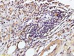 TIMP-1 Antibody in Immunohistochemistry (Paraffin) (IHC (P))