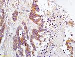 TIMP-1 Antibody in Immunohistochemistry (Paraffin) (IHC (P))