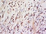 TIMP-1 Antibody in Immunohistochemistry (Paraffin) (IHC (P))