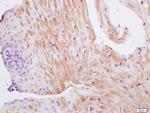 TIMP-1 Antibody in Immunohistochemistry (Paraffin) (IHC (P))