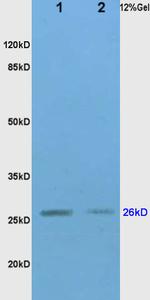 TIMP-1 Antibody in Western Blot (WB)