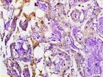 MMP-7 Antibody in Immunohistochemistry (Paraffin) (IHC (P))