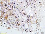 MMP-7 Antibody in Immunohistochemistry (Paraffin) (IHC (P))