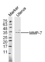 MMP-7 Antibody in Western Blot (WB)