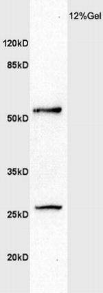 MMP-1 Antibody in Western Blot (WB)