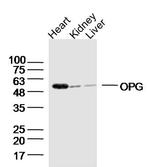 OPG Antibody in Western Blot (WB)