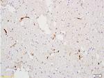 Factor 8 Antibody in Immunohistochemistry (Paraffin) (IHC (P))