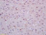 ACTH 18-39 Antibody in Immunohistochemistry (Paraffin) (IHC (P))