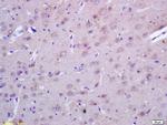 ACTH 1-39 Antibody in Immunohistochemistry (Paraffin) (IHC (P))