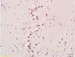 NIS Antibody in Immunohistochemistry (Paraffin) (IHC (P))