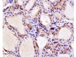 NIS Antibody in Immunohistochemistry (Paraffin) (IHC (P))