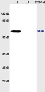 NIS Antibody in Western Blot (WB)