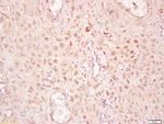 Phospho-SMAD2 (Ser465) Antibody in Immunohistochemistry (Paraffin) (IHC (P))