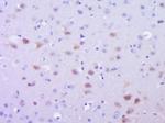 Phospho-SMAD2 (Ser465) Antibody in Immunohistochemistry (Paraffin) (IHC (P))