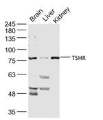 TSHR Antibody in Western Blot (WB)