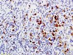 MMP-1 Antibody in Immunohistochemistry (Paraffin) (IHC (P))