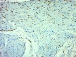 NFKB p65 Antibody in Immunohistochemistry (Paraffin) (IHC (P))