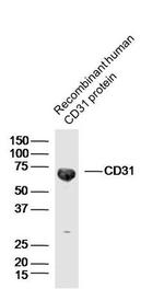 CD31 Antibody in Western Blot (WB)