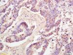 Adiponectin Antibody in Immunohistochemistry (Paraffin) (IHC (P))