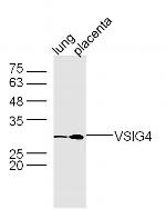 VSIG4 Antibody in Western Blot (WB)