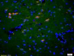 EphA2 Antibody in Immunohistochemistry (Paraffin) (IHC (P))