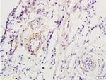 ADRB1 Antibody in Immunohistochemistry (Paraffin) (IHC (P))