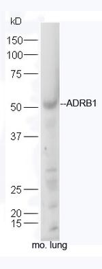 ADRB1 Antibody in Western Blot (WB)