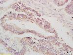 ATF3 Antibody in Immunohistochemistry (Paraffin) (IHC (P))