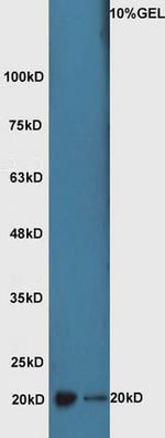 ATF3 Antibody in Western Blot (WB)