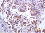 5 lipoxygenase Antibody in Immunohistochemistry (Paraffin) (IHC (P))