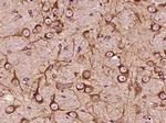 5 lipoxygenase Antibody in Immunohistochemistry (Paraffin) (IHC (P))