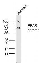 PPAR gamma Antibody in Western Blot (WB)