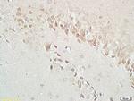 GABABR1 Antibody in Immunohistochemistry (Paraffin) (IHC (P))