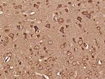 CaMK2 Antibody in Immunohistochemistry (Paraffin) (IHC (P))