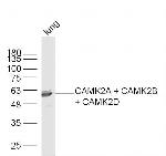 CaMK2 Antibody in Western Blot (WB)
