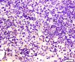 SCF Antibody in Immunohistochemistry (Paraffin) (IHC (P))