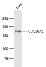 COL18A1 Antibody in Western Blot (WB)