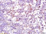 MERTK Antibody in Immunohistochemistry (Paraffin) (IHC (P))